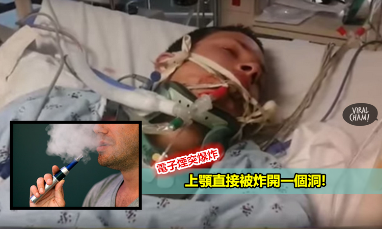 【看你还敢不敢抽电子烟】男子抽电子烟突爆炸!