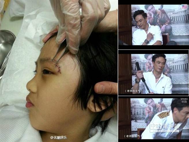 6歲兒視力永久性傷害 吳鎮宇抓狂怒摔麥